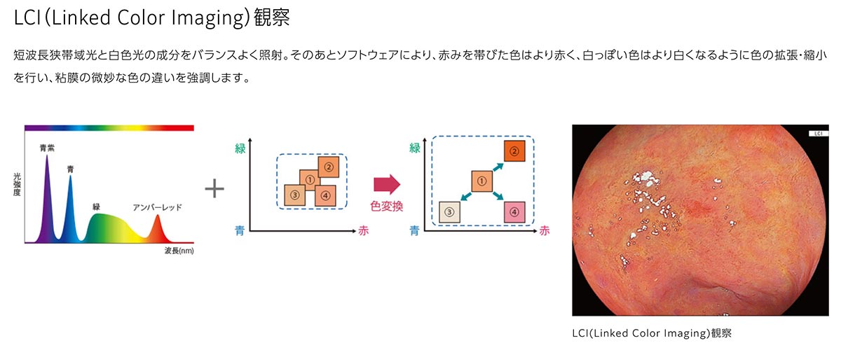 画像強調観察BLI/LCI機能