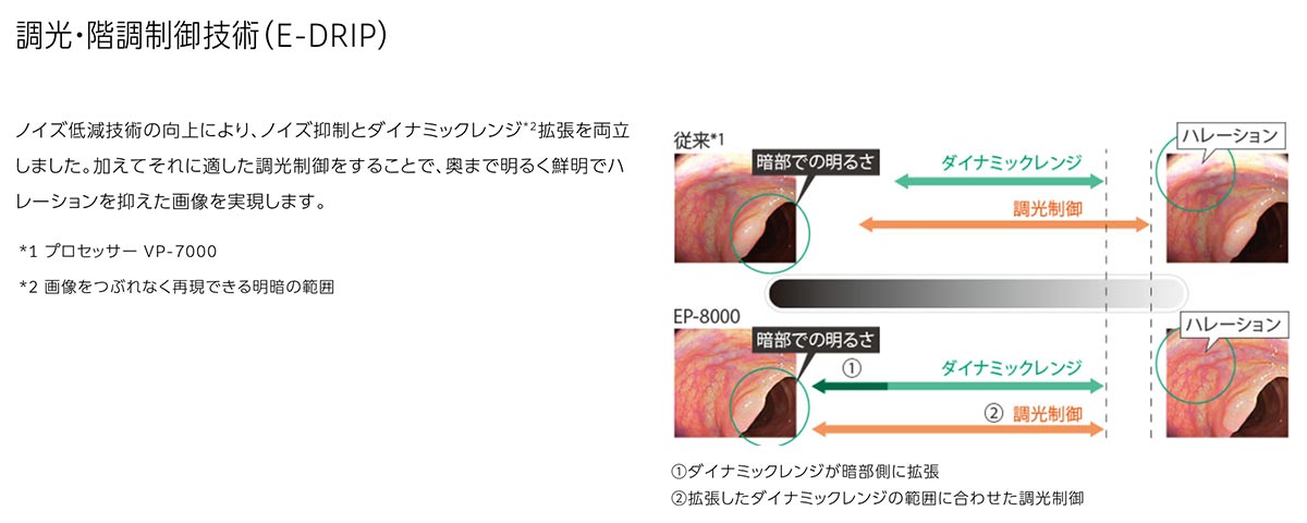 画像強調観察BLI/LCI機