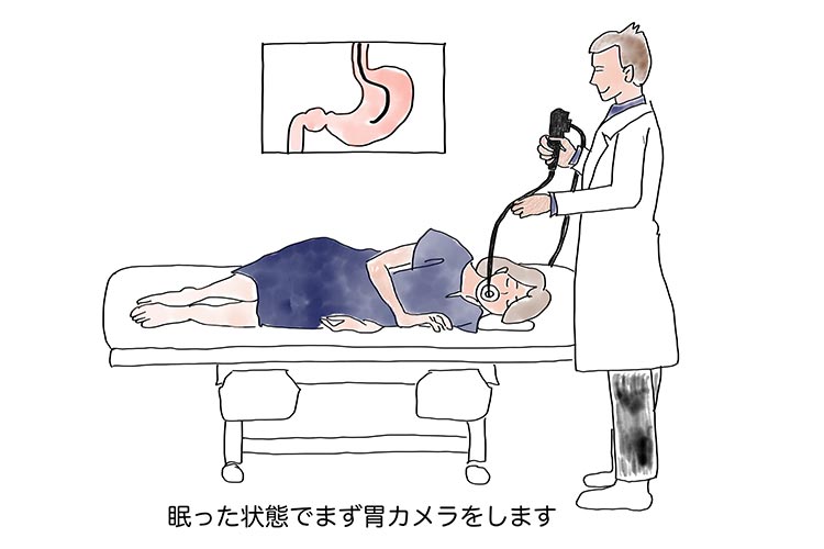 胃カメラ