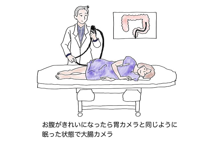 大腸カメラ